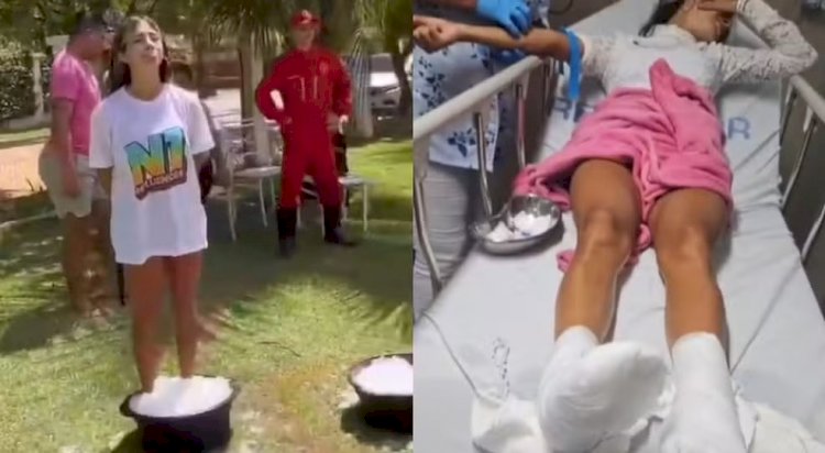 Influenciadores têm queimaduras e são socorridos após ficarem com pés imersos em gelo com sal para reality